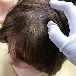 Human Hair Implants