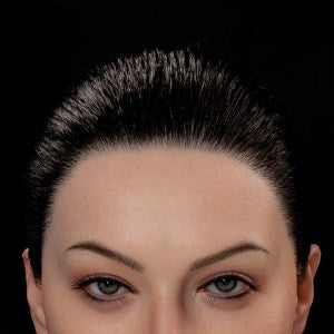 Implanted Synthetic Hair